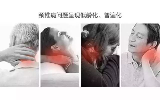 頸椎病問題呈現低齡化/普遍化