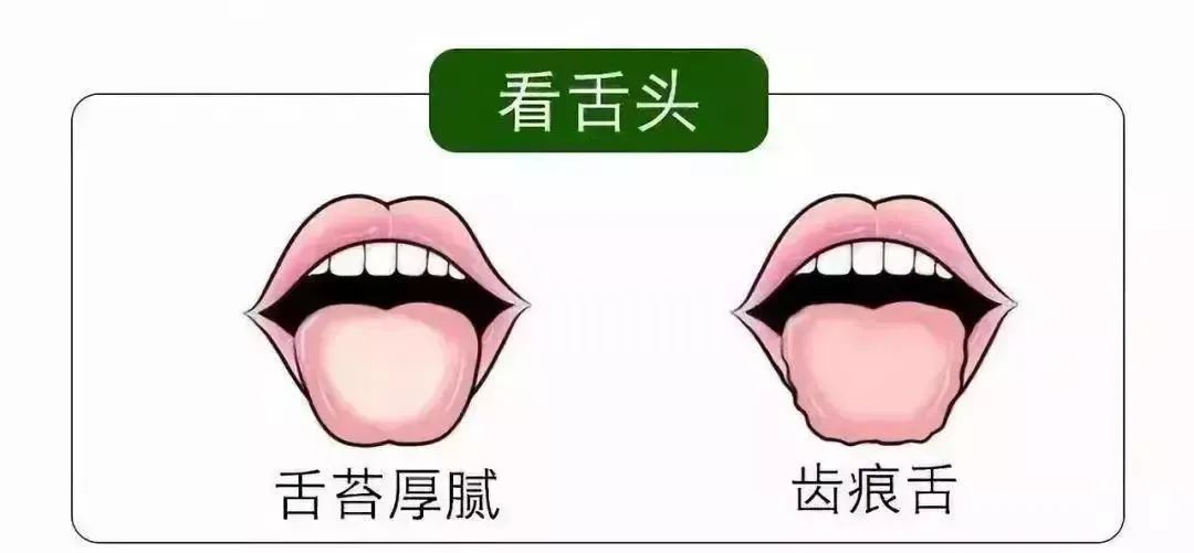 清明時(shí)節(jié)雨紛紛 疏通經(jīng)絡(luò)馬上給身體加分！